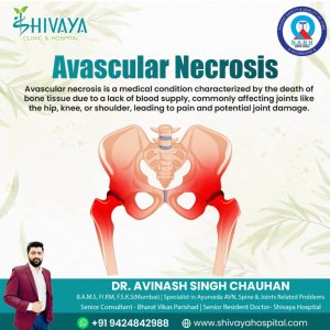 India’s best doctor for avascular necrosis – treat without surge