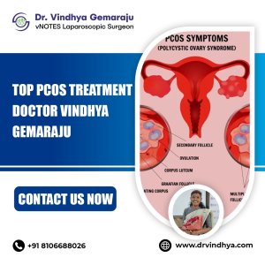 Best pcos treatment doctor in hyderabad – dr vindhya gemaraju