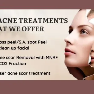 The best acne treatment in thane at dna royal aesthetic clinic
