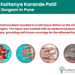 Dr chaitanya karande patil | best orthopedic doctor in pune, ko