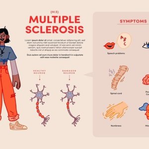 How multiple sclerosis impacts daily life and well-being