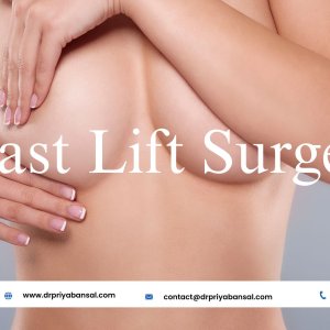 Dr priya bansal performs breast lift surgery to achieve youthfu