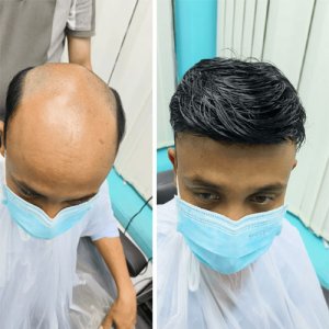 Smart hair fixing