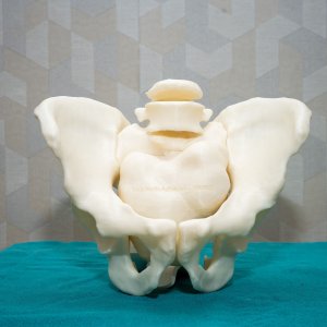 Curewith3d - get 3d precision in every 3d surgical models