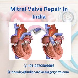 Mitral valve price in india