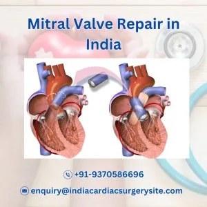 Mitral valve price in india