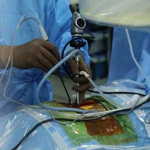 Spine surgery in ahmedabad