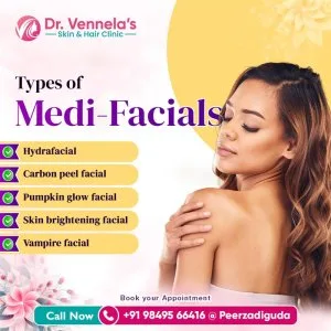 Best skin specialist in peerzadiguda | hair loss treatment in pe