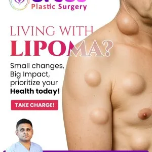 Gynecomastia treatment in hyderabad | best plastic surgery clini