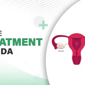 Pcos treatment in noida by expert doctors – cost guide