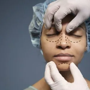 Expert rhinoplasty in lucknow by dr sumit malhotra
