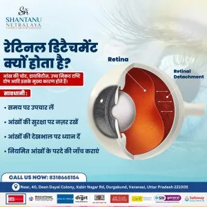 Retina specialist in varanasi – advanced retina care & treatment