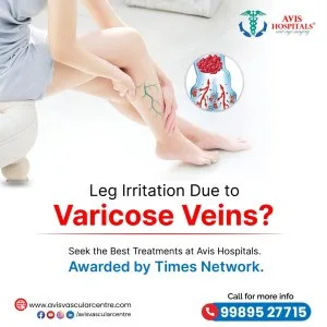 Varicose veins treatment in anantapur