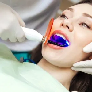 Dental clinic | bangalore | best dental care |