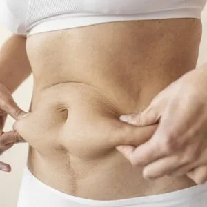 Looking for expert tummy tuck doctors in thane?