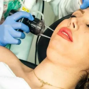 Laser hair removal in bangalore: the smooth, lasting solution yo