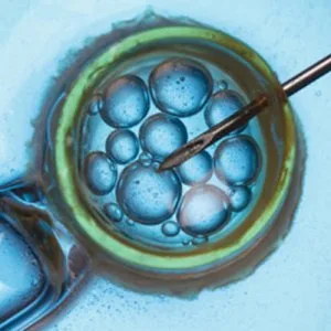 Top ivf treatment centre in bangalore