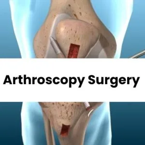 Arthroscopy surgery in punjab | elite orthopaedics