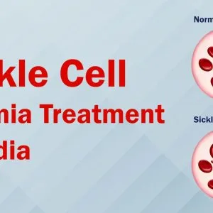 Affordable sickle cell anemia treatment cost in india | bmt clin