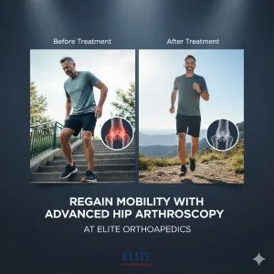Regain mobility with advanced hip arthroscopy at elite orthopaed
