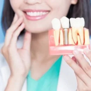 Dental implant surgery treatment in gangapur road, nashik