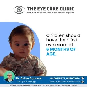 Experienced cataract surgeon near lucknow – safe & painless surg