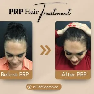 Trusted skin specialist in kondhwa – book your appointment