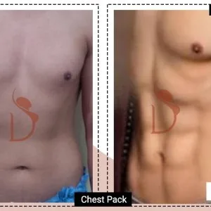 Six pack abs surgery | sculpted abs with advanced abdominal etch