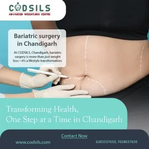 Top bariatric surgery centre, chandigarh – codsils