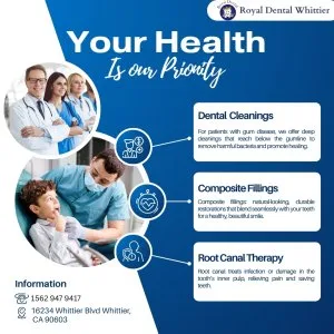 Composite fillings whittier, ca | tooth colored resin filling