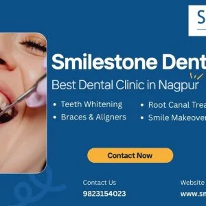 Smilestone dentist - best dental clinic in nagpur