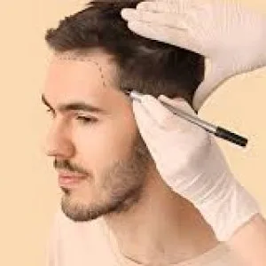 Best hair transplant in srinagar for natural results