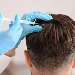 Best hair transplant doctors in chandigarh for natural results
