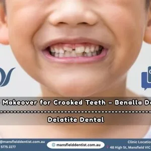 Smile makeover for crooked teeth – benalla dentist
