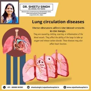 Experienced asthma specialist in jaipur – dr sheetu singh