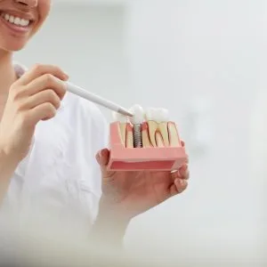 Get permanent dental implants in kurla with expert care