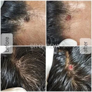 Nirmal Skin care and eye care Hospital