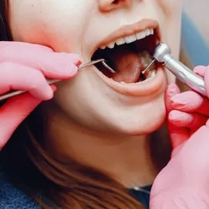 Best dental clinic with top dentist in alwarpet, 