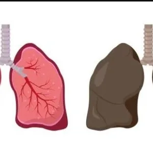 Tuberculosis specialist in jaipur, rajasthan | expert tb treatme