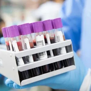 Affordable gut microbiome test for better digestion