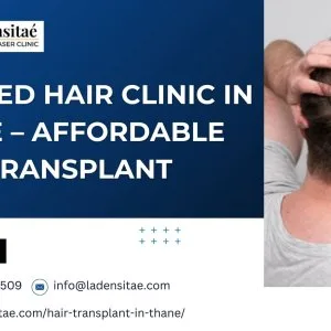 Trusted hair clinic in thane – affordable hair transplant