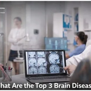 What are the top 3 brain diseases?