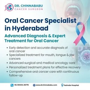 Oral cancer specialist in hyderabad