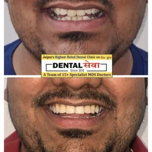 Dental hospital in vaishali nagar teeth braces jaipur dental