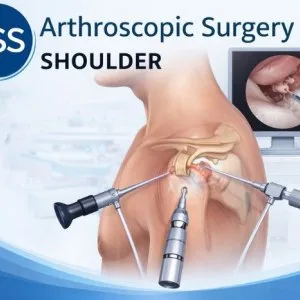 Shoulder dislocation surgery doctor in delhincr
