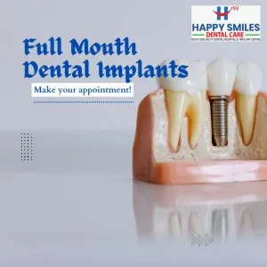 Full month dental implants your complete guide to a permanent
