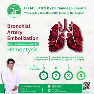 Bronchial artery embolization in interventional radiology