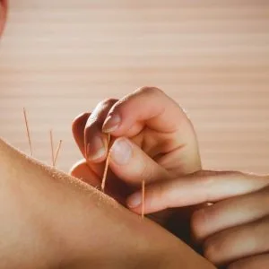Online sujok treatment in ahmedabad
