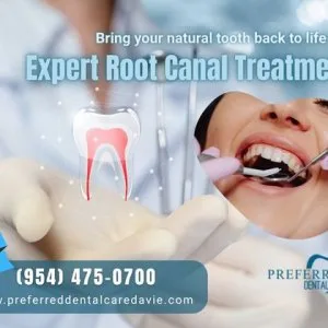 Affordable root canal treatment in davie restore your smile