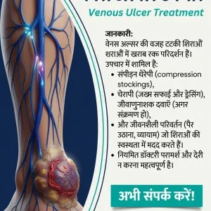 Venous ulcer treatment